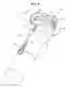 Fig. 09 - Tethering assembly and method for grinders and like tools
