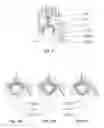 Fig. 06 - Brewing device having two brewing chambers