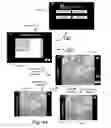 Fig. 25 - Method and apparatus for hysteroscopy and endometrial biopsy