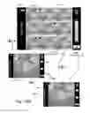 Fig. 27 - Method and apparatus for hysteroscopy and endometrial biopsy