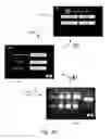 Fig. 28 - Method and apparatus for hysteroscopy and endometrial biopsy