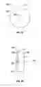 Fig. 04 - Endoscopic device with drip flange and methods of use thereof for an operative procedure