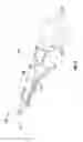 Fig. 05 - Endoscopic device with drip flange and methods of use thereof for an operative procedure