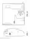 Fig. 02 - Ulcer Detection Apparatus and Method with Varying Thresholds