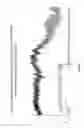 Fig. 10 - Method and system enabling photoplethysmograph measurement of volume status