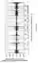 Fig. 50 - Method and system enabling photoplethysmograph measurement of volume status
