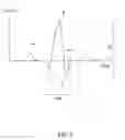 Fig. 05 - Method and medical device for discriminating between a supraventricular tachycardia and a ventricular tachycardia