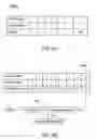 Fig. 09 - Method and medical device for discriminating between a supraventricular tachycardia and a ventricular tachycardia