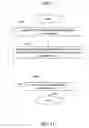Fig. 12 - Method and medical device for discriminating between a supraventricular tachycardia and a ventricular tachycardia