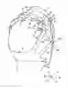 Fig. 01 - Headwear for electroencephalography