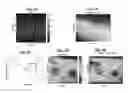 Fig. 06 - Method and apparatus to measure tissue displacement and strain