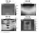 Fig. 07 - Method and apparatus to measure tissue displacement and strain