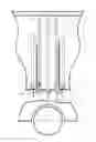 Fig. 01 - Method of conducting a minimally invasive surgical procedure and rkh-i apparatus for the implementation thereof