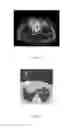 Fig. 04 - Method of conducting a minimally invasive surgical procedure and rkh-i apparatus for the implementation thereof