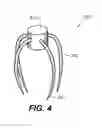Fig. 08 - Closing openings in anatomical tissue