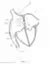 Fig. 09 - SHAPED DELIVERY SHEATH AND METHODS