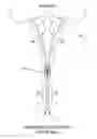 Fig. 01 - Tissue fixation and closure suture articles and suture placement devices