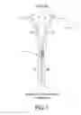 Fig. 02 - Tissue fixation and closure suture articles and suture placement devices
