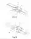 Fig. 04 - Tissue fixation and closure suture articles and suture placement devices