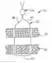 Fig. 01 - METHOD AND DEVICE FOR SECURING BODY TISSUE