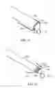 Fig. 23 - METHOD AND DEVICE FOR SECURING BODY TISSUE