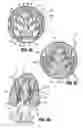 Fig. 22 - Surgical instrument