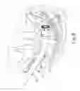 Fig. 12 - Circular surgical stapler with recessed deck
