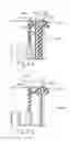 Fig. 17 - Circular surgical stapler with recessed deck