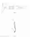 Fig. 04 - Open-close-repeatable rotatable hemoclip for the gastrointestinal tract with electrocoagulation