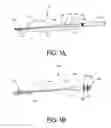 Fig. 02 - Adjustable Heart Valve Implant