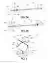 Fig. 03 - Adjustable Heart Valve Implant