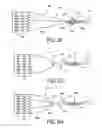 Fig. 07 - Adjustable Heart Valve Implant