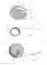 Fig. 06 - Devices and methods for the treatment of vascular defects