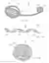 Fig. 10 - Devices and methods for the treatment of vascular defects