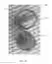 Fig. 13 - Devices and methods for the treatment of vascular defects