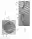 Fig. 14 - Devices and methods for the treatment of vascular defects