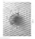 Fig. 17 - Devices and methods for the treatment of vascular defects