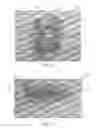 Fig. 19 - Devices and methods for the treatment of vascular defects