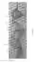 Fig. 20 - Devices and methods for the treatment of vascular defects
