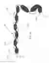 Fig. 22 - Devices and methods for the treatment of vascular defects