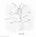 Fig. 31 - Devices and methods for the treatment of vascular defects