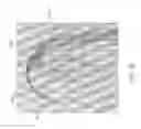 Fig. 41 - Devices and methods for the treatment of vascular defects