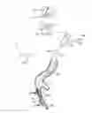 Fig. 01 - Lung volume-reducing elastic implant and instrument