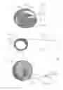 Fig. 06 - Devices and methods for the treatment of vascular defects