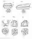 Fig. 06 - Surgical trabecular tool and method for manufacturing