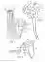 Fig. 03 - Patient specific glenoid guide