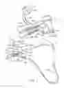Fig. 04 - Patient specific glenoid guide