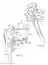 Fig. 05 - Patient specific glenoid guide
