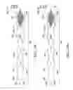 Fig. 112 - CLOT RETRIEVAL SYSTEM