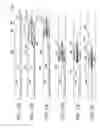 Fig. 33 - CLOT RETRIEVAL SYSTEM